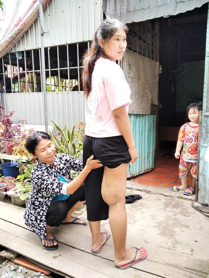 Cha bị bệnh tim, con không tiền tháo khớp